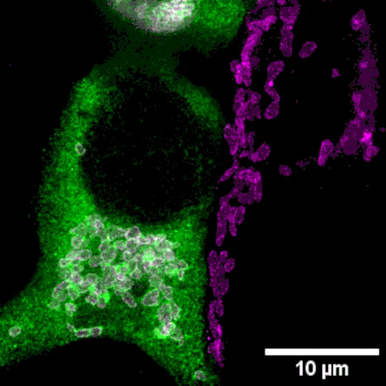 Demonstration-That-Part-of-the-Transporter-Is-Located-in-Mitochondria.webp