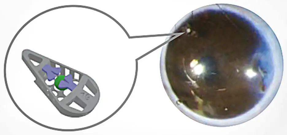 Diabetes-Eye-Implant-Microdevice.webp