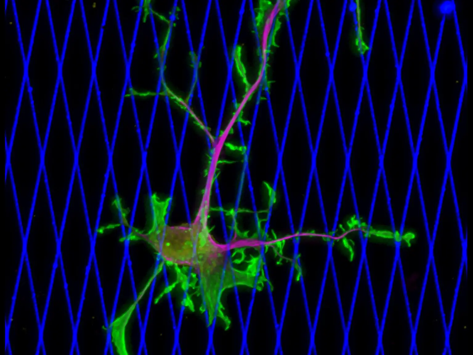 A-Human-Breast-Cancer-Cell-1536x1152.webp