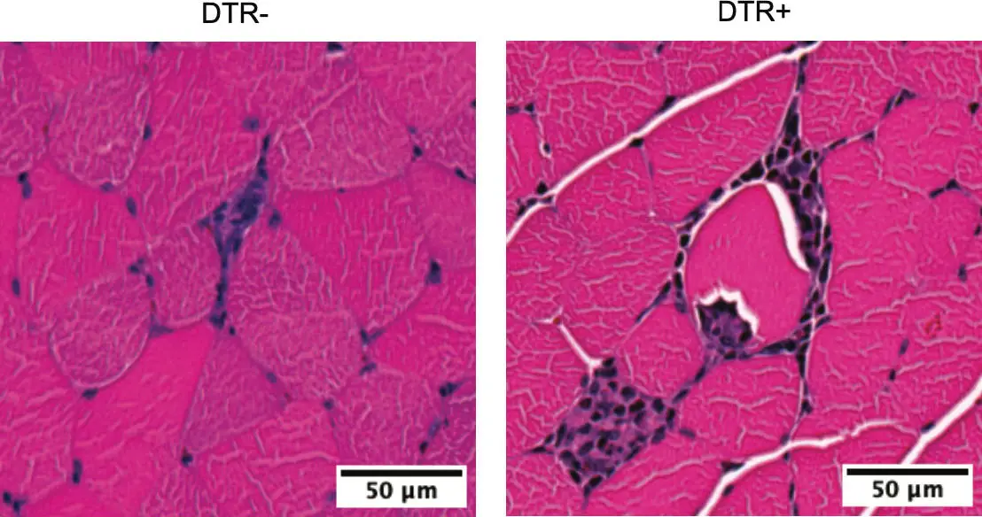 Immune-Cells-Mobilized-During-Exercise-Counter-Exercise-Induced-Inflammation.webp