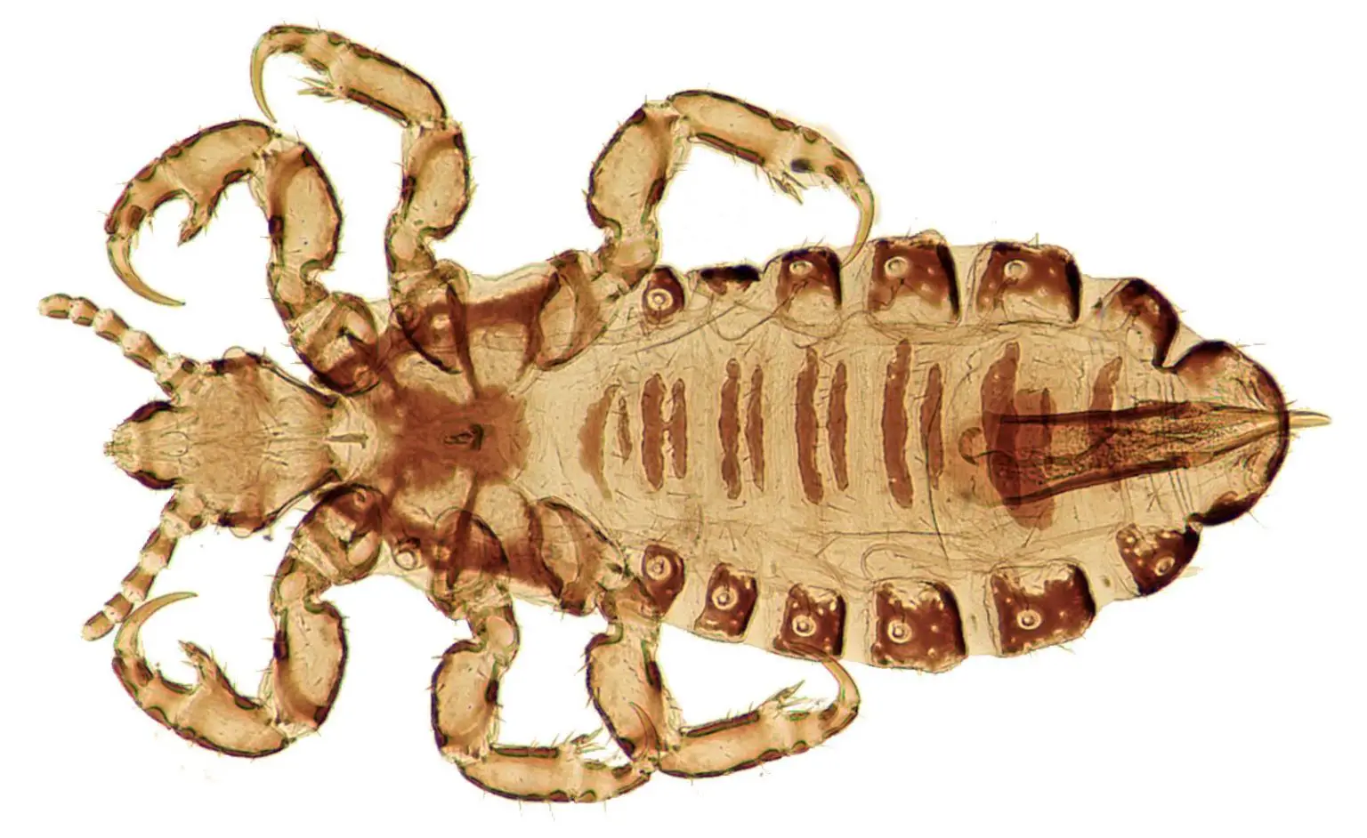 Head-Louse-1536x942.webp