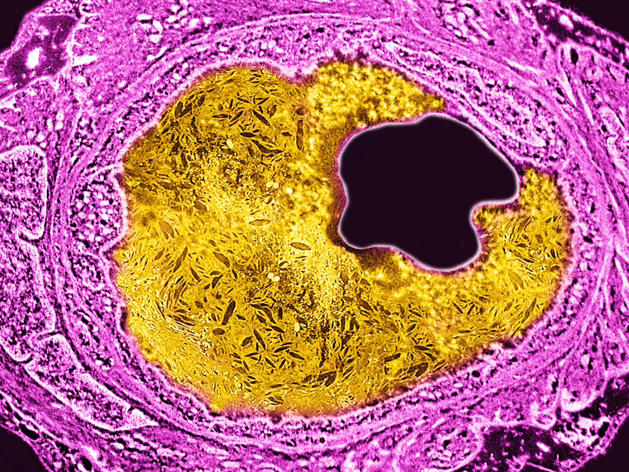 arteries-science-GettyImages-1404559512.webp