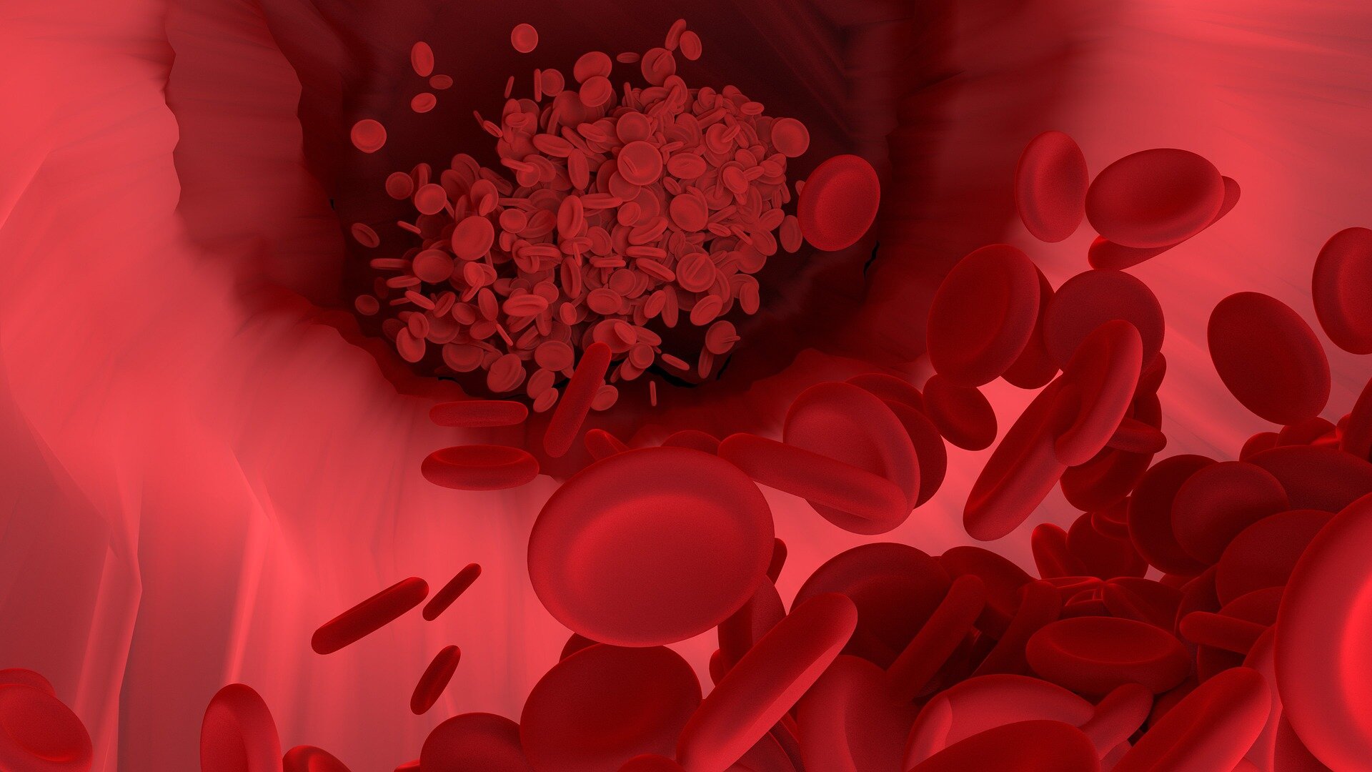 blood-vessel-1.jpg