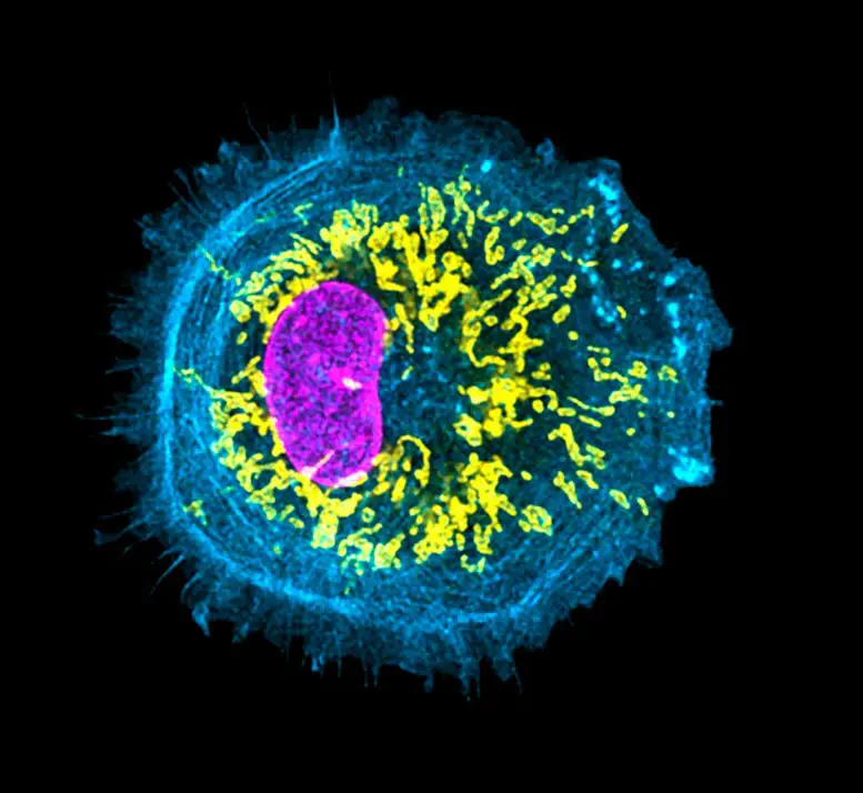 Super-Resolution-Image-of-Human-Stem-Cell-Derived-Microglia-Cells.webp