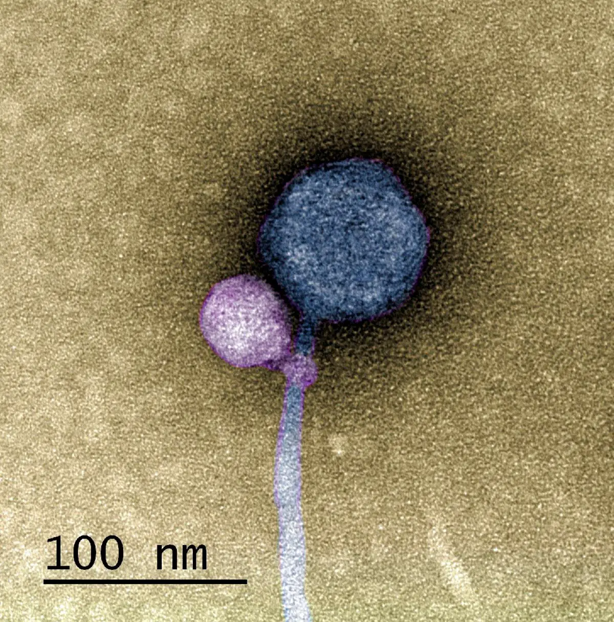 Satellite-Virus-Latched-Onto-Its-Helper.webp