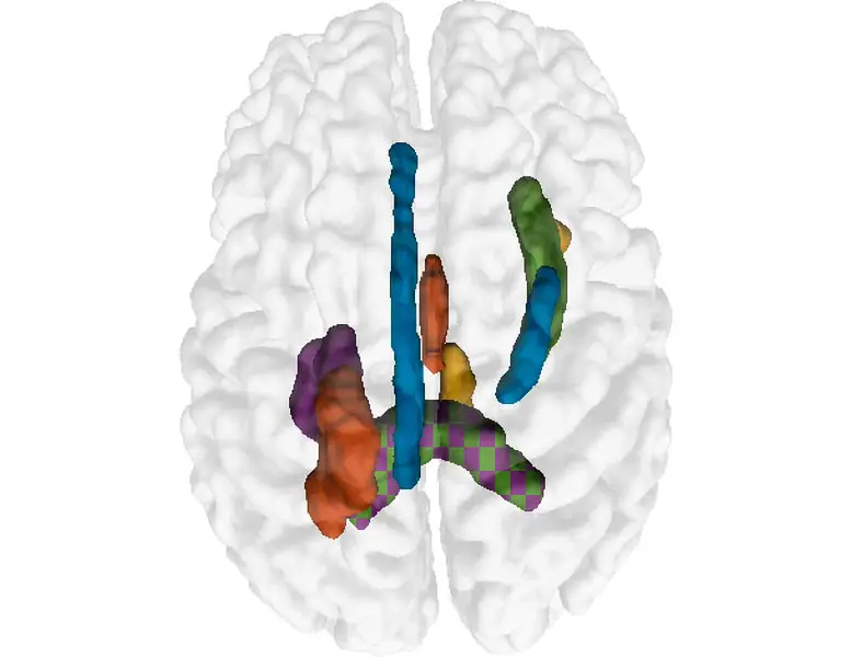Top-Five-White-Matter-Brain-Features 图像，777x600 像素）.jpg