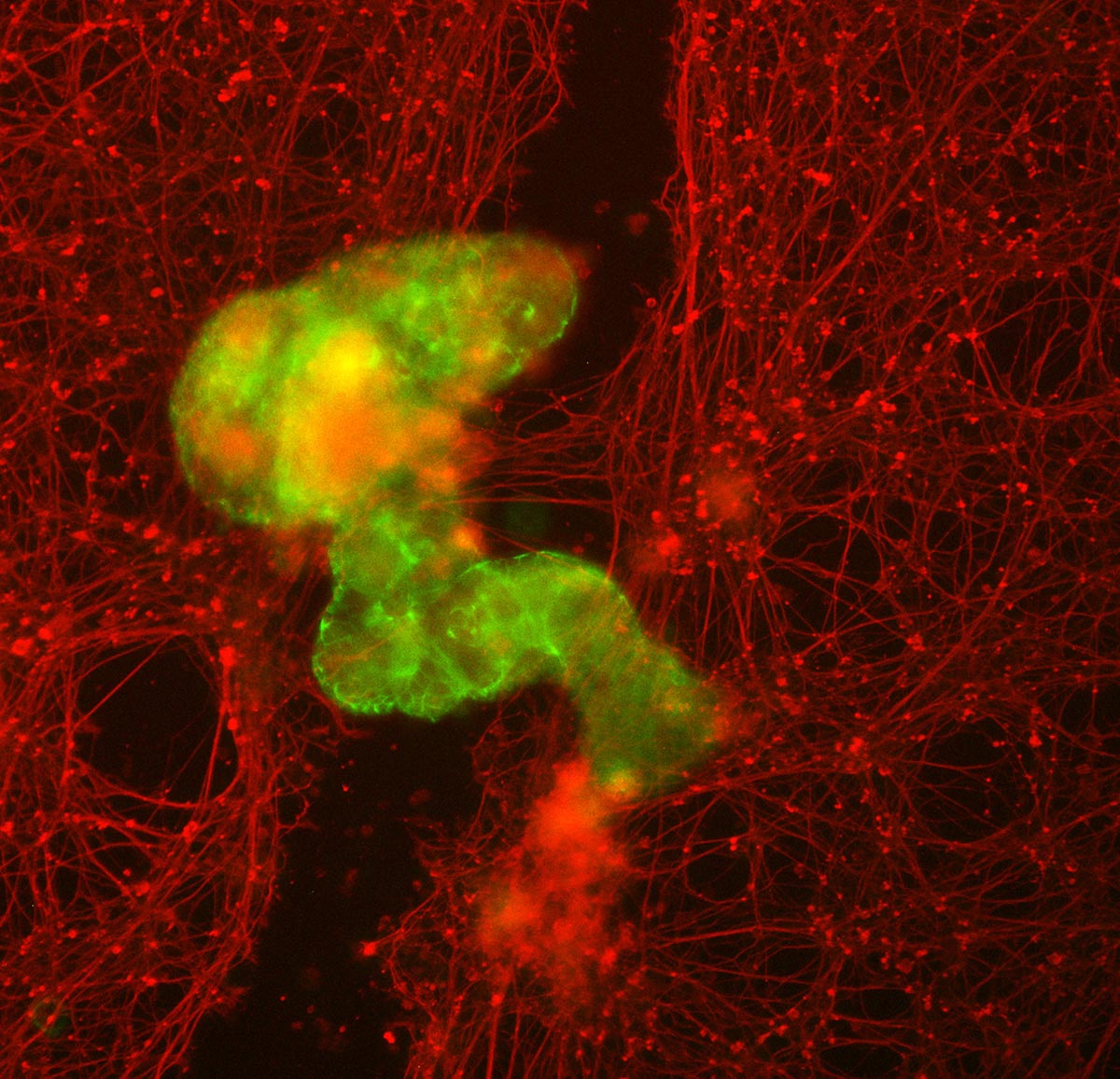 Superbot-Healing-Neuronal-Gap.jpg