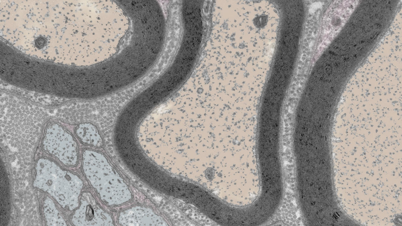 Cross-Section-of-Mouse-Sciatic-Nerves.jpg