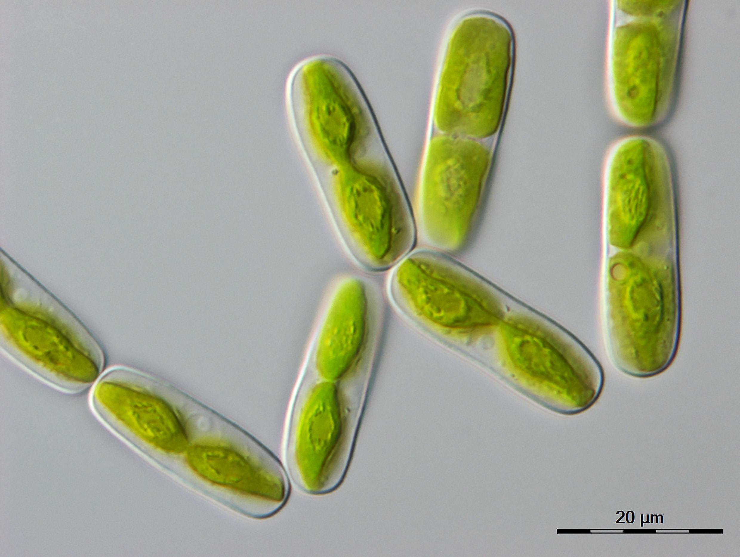 Microscope-Image-of-Mesotaenium-endlicherianum.jpg