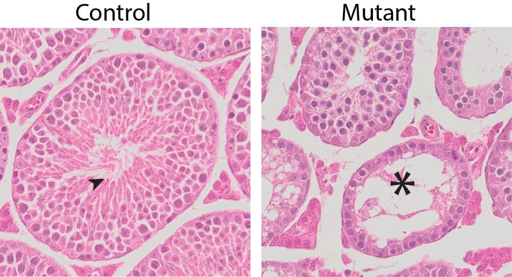 Normal-Seminiferous-Tubules-in-Control-Testes.jpg