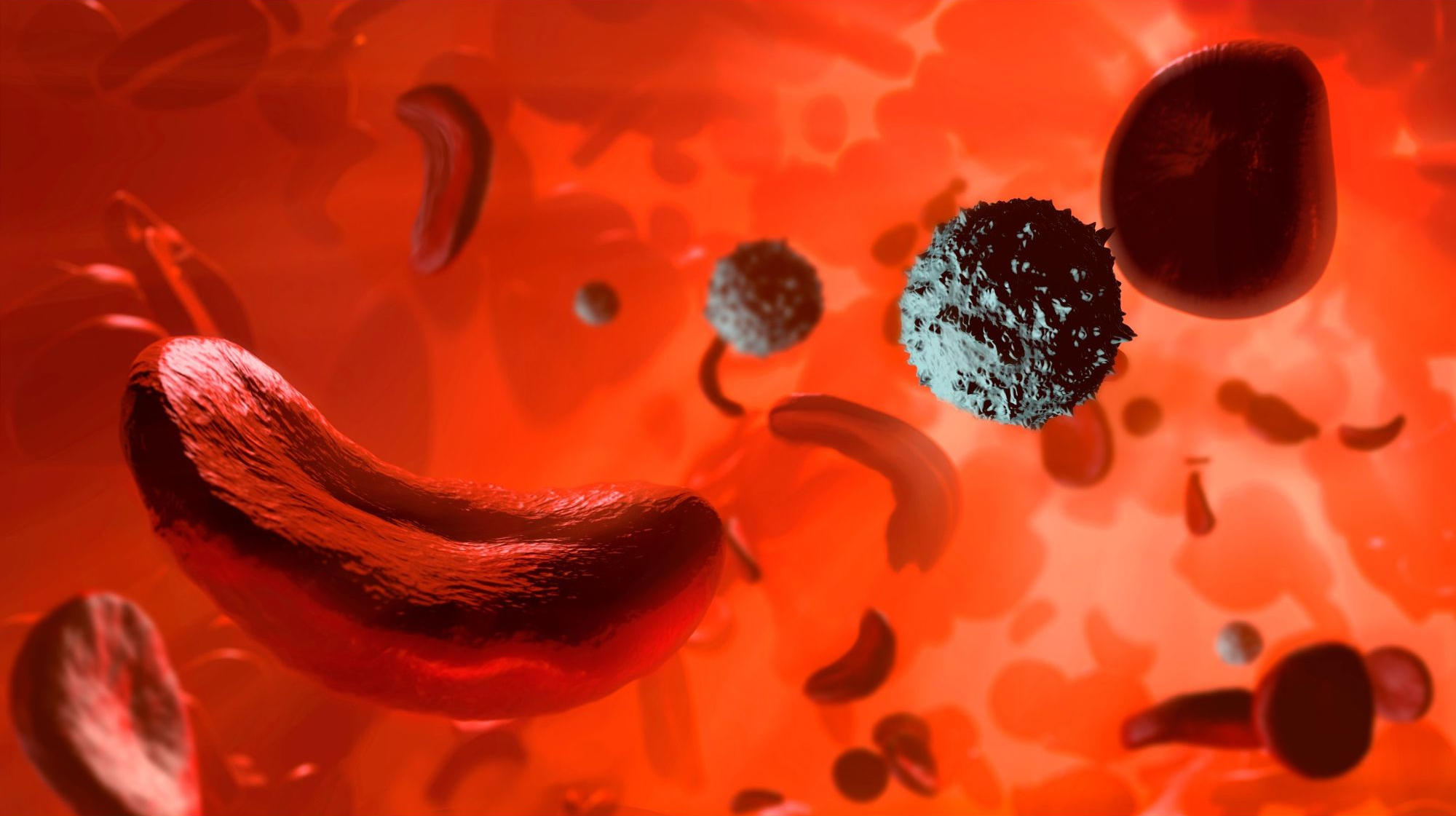 Sickle-Cell-Disease.jpg