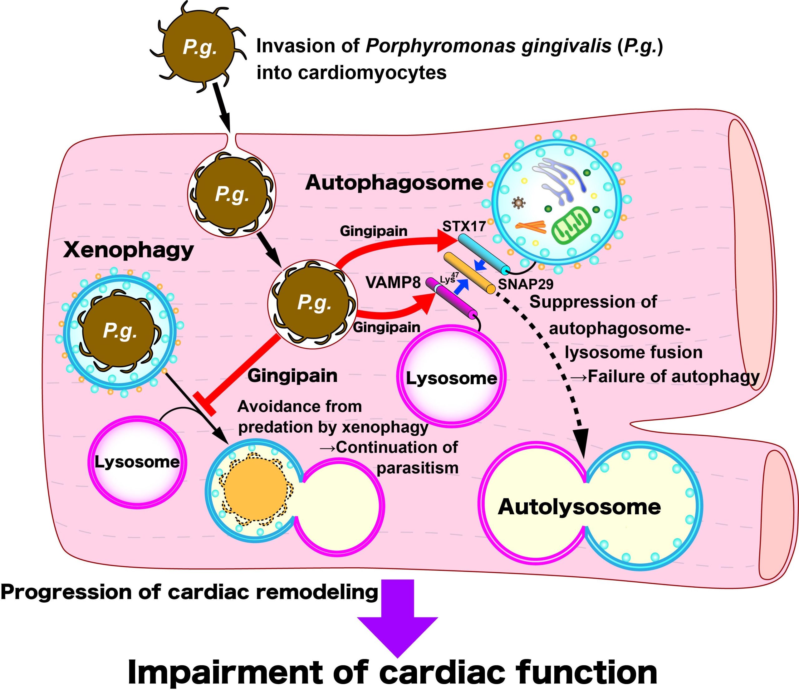 The-Dual-Suppressive-Effect-of-Gingipain-on-Both-Xenophagy-and-Autophagy-scaled.jpg