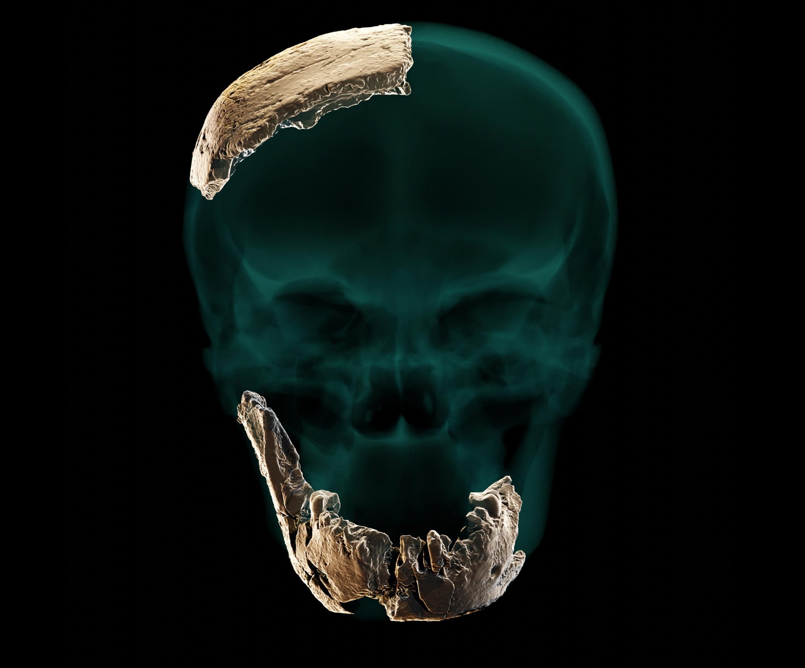 Static-Skull-Mandible-Parietal-Orthographic-scaled.jpg