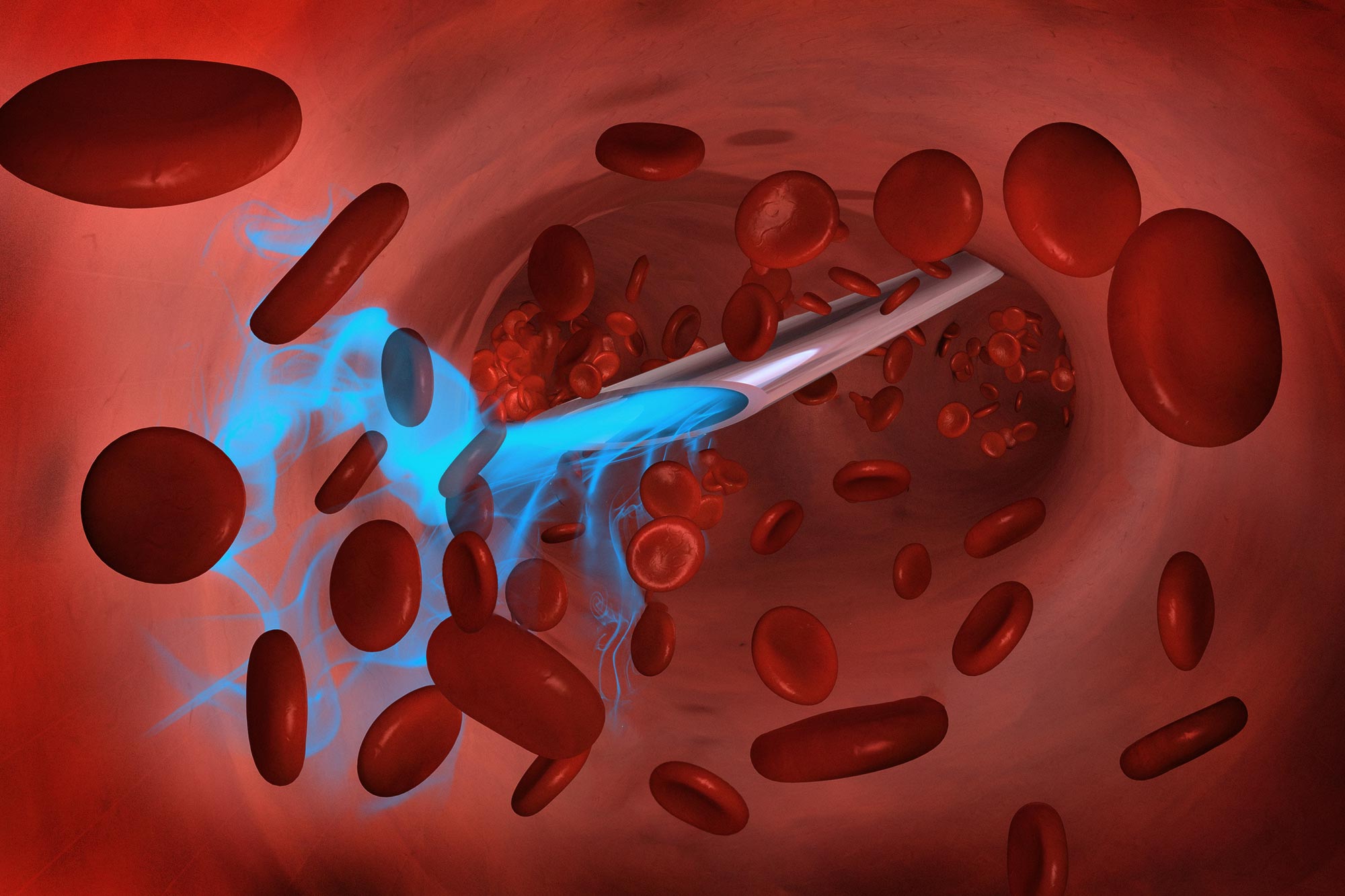 Ultrafast-Insulin-Injection-Concept.jpg