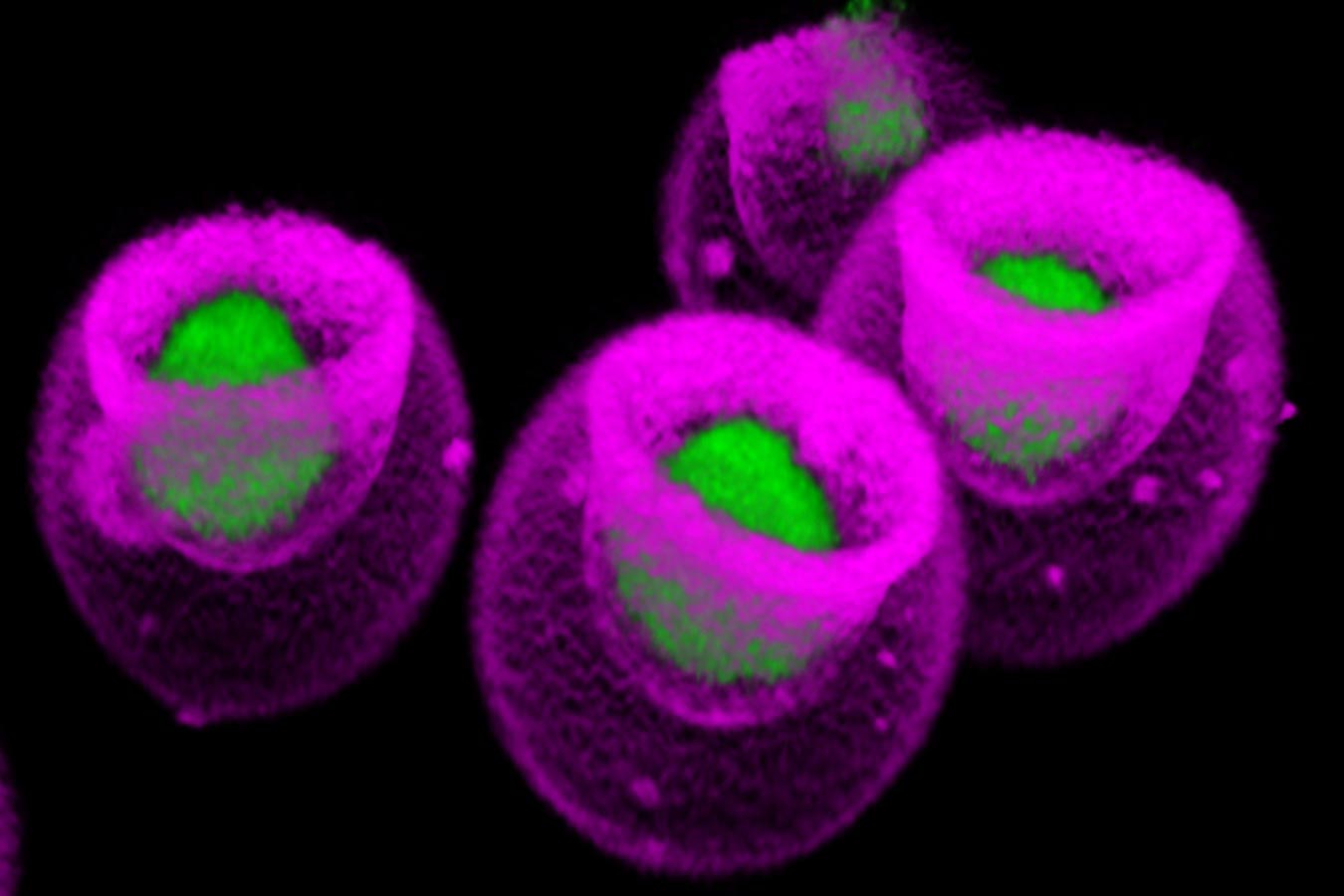 Mesenchymal-Cells.jpg
