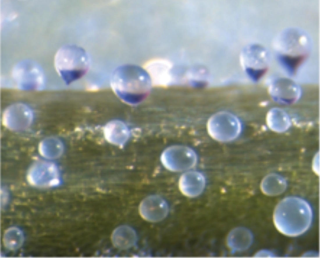 Epidermal-Bladder-Cells-Seen-Through-a-Microscope.jpg