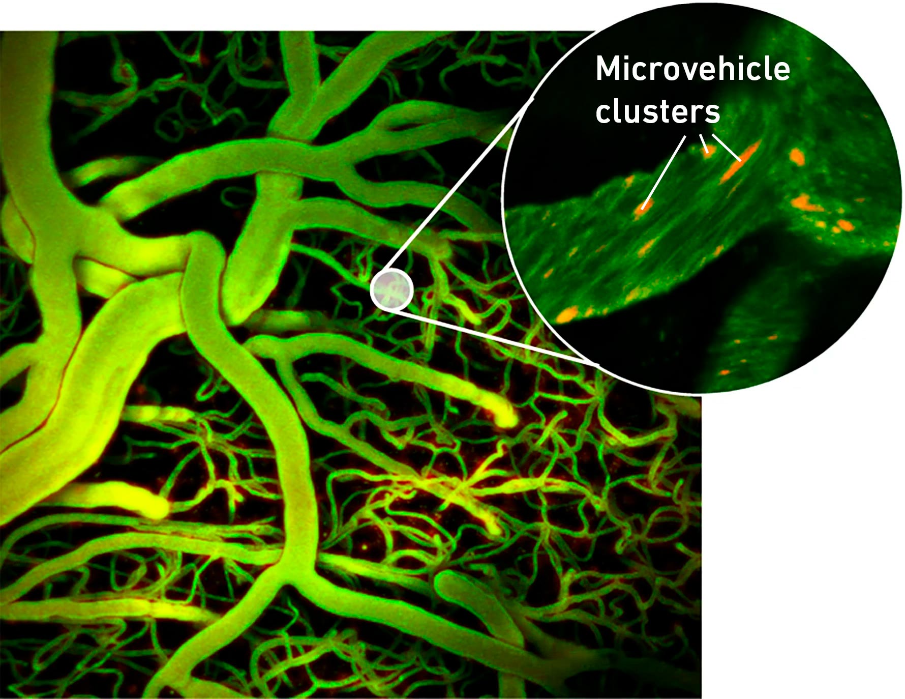 Brain-Blood-Vessels-Microvehicle-Clusters.jpg