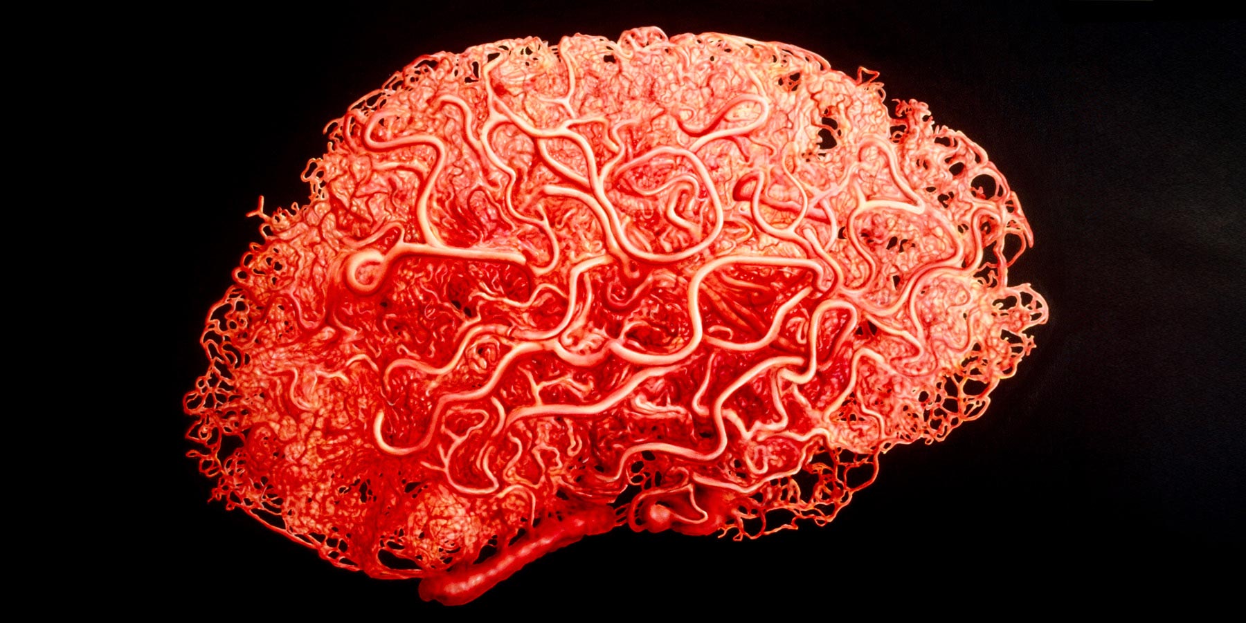 Blood-Supply-in-Brain.jpg