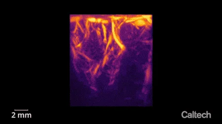 Ultrasound-Brain-Imaging.webp