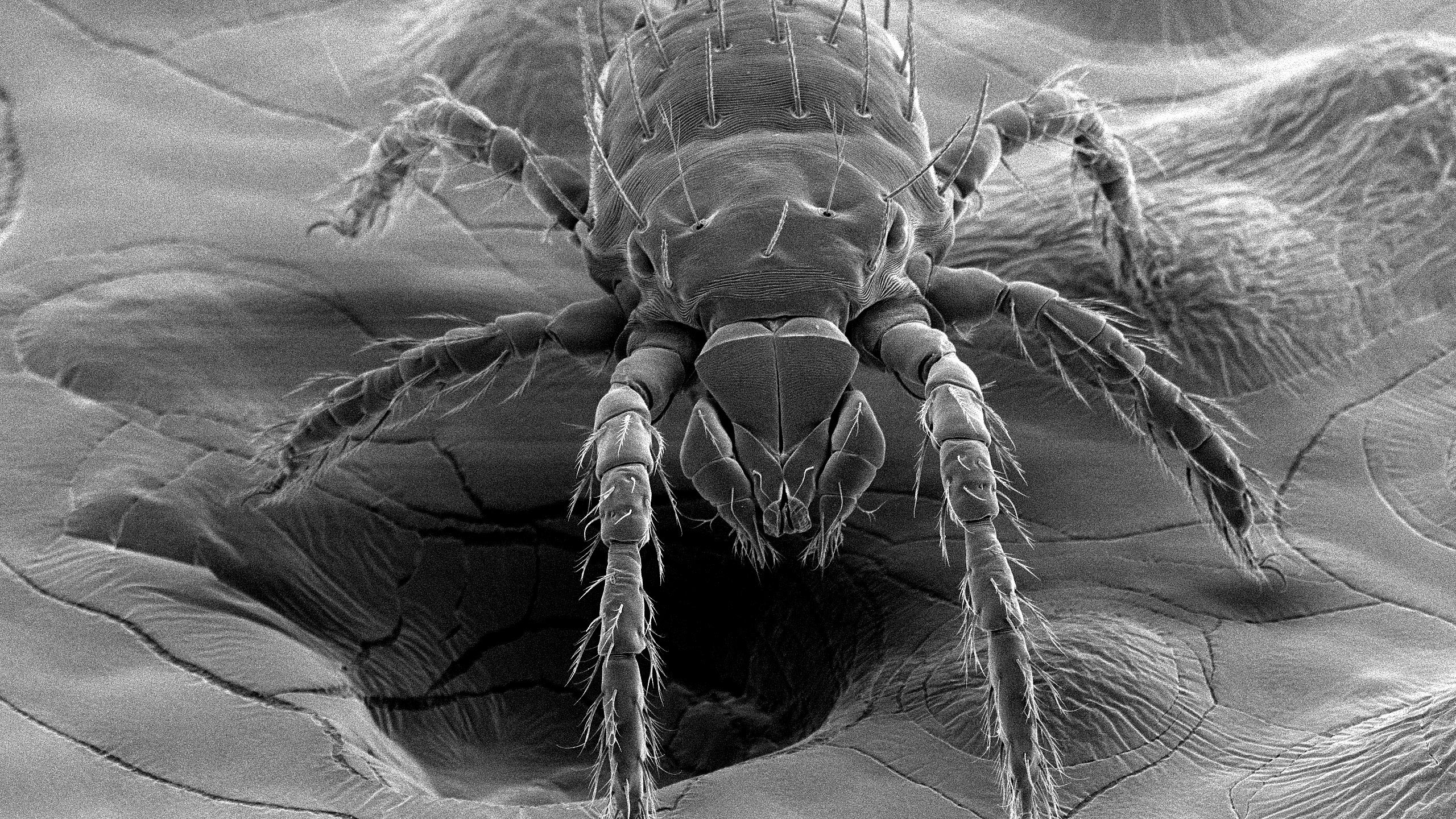 Chigger-Scanning-Electron-Microscopy.jpg