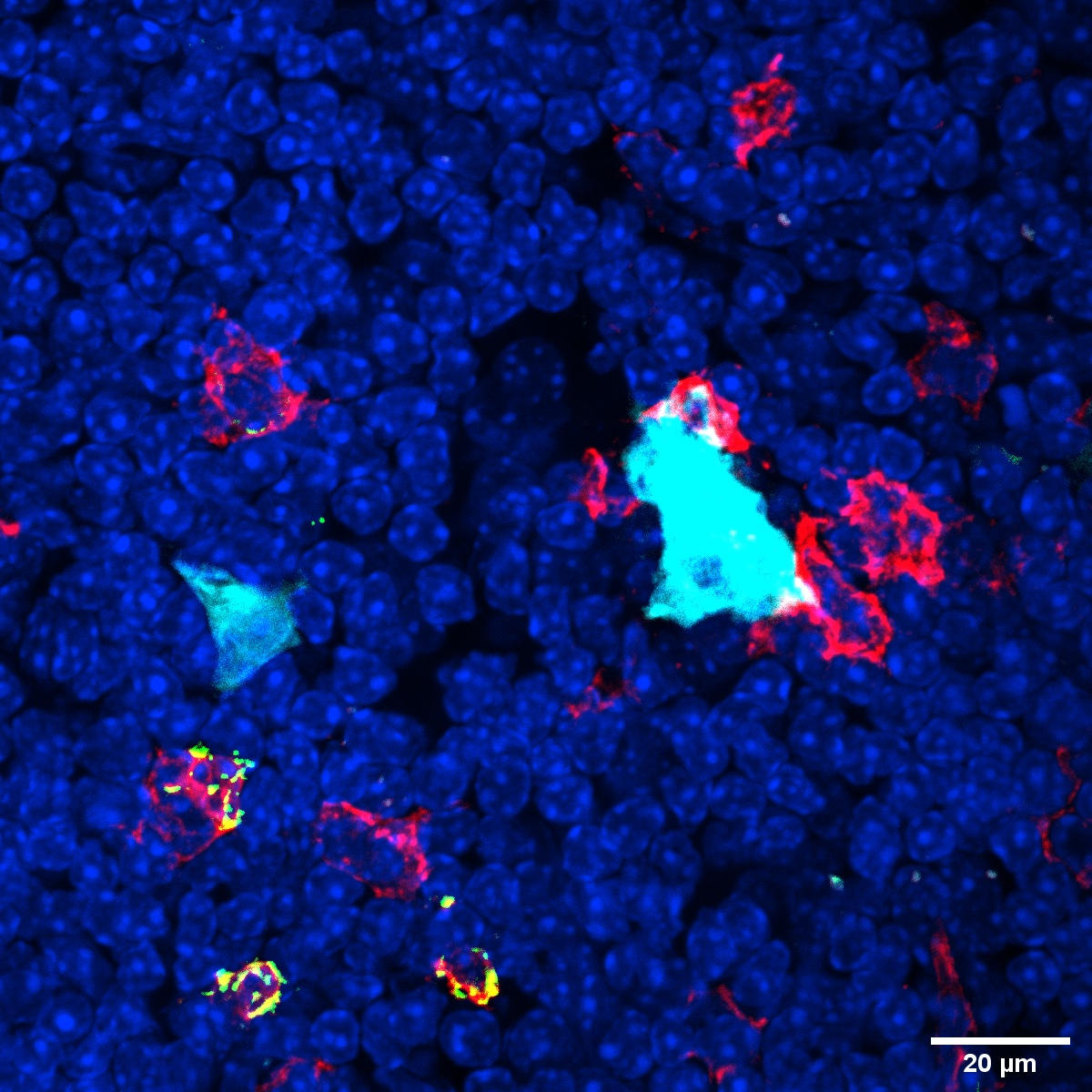 Thymic-Cells.jpg