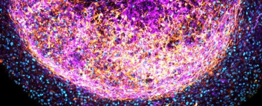 TissueBrainOrganoid.jpg