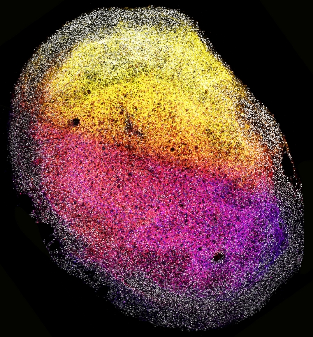 WholeHumanBrainFetalOrganoid.jpg