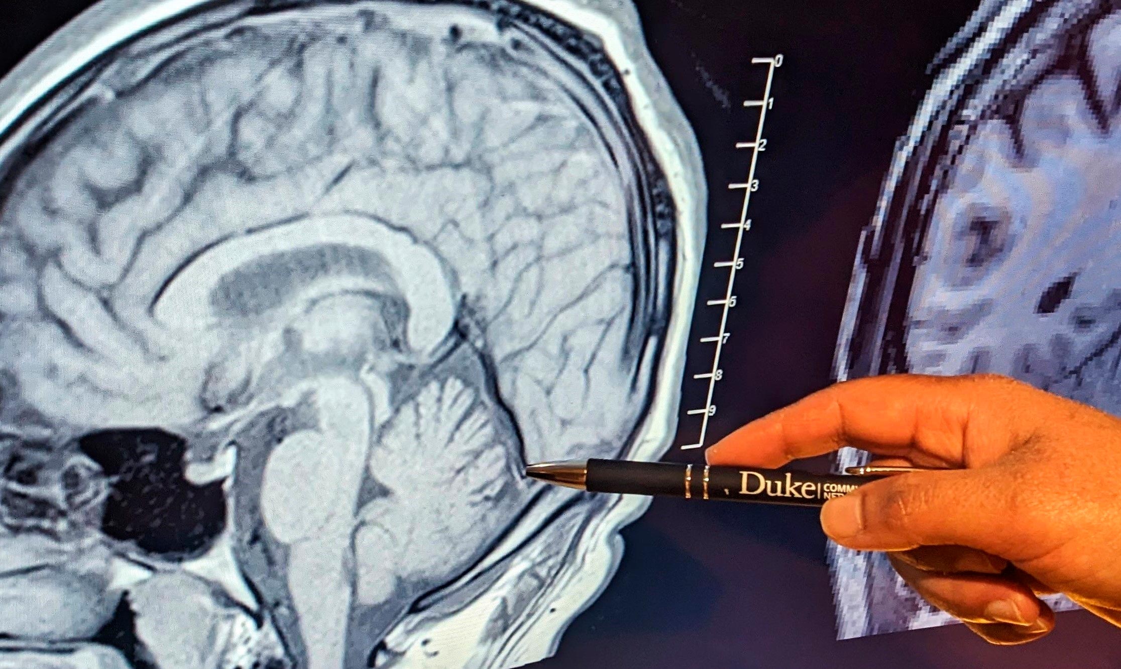 Human-Brain-Cerebellum.jpg