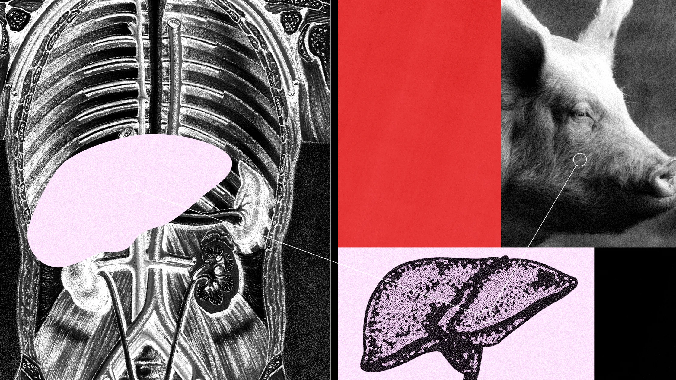 science_pig_liver_organ_transplant.webp