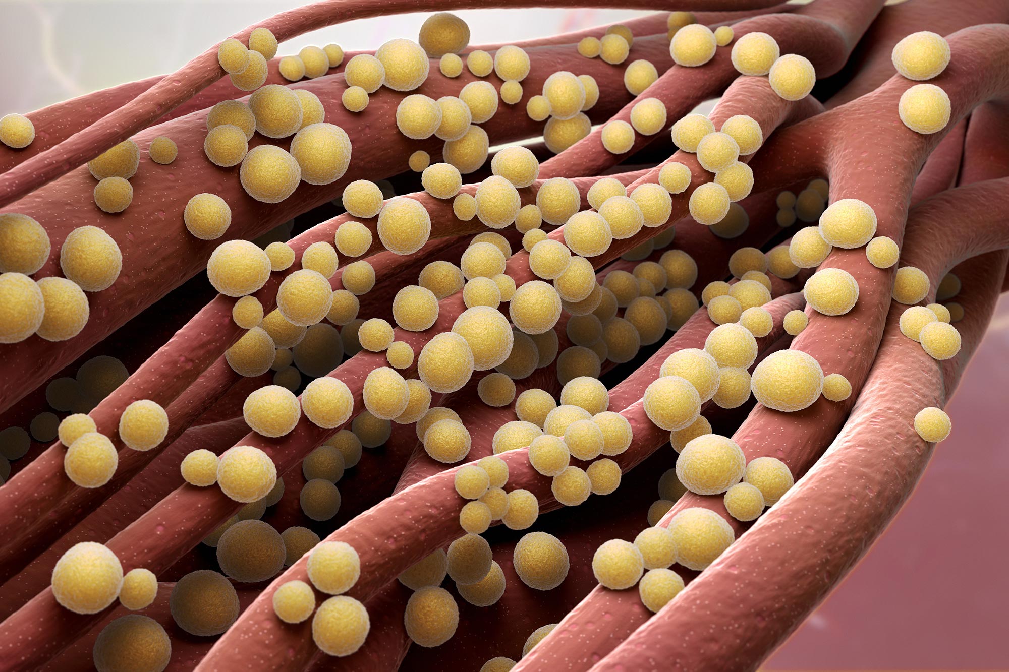 Staphylococcus-aureus-Illustration.jpg