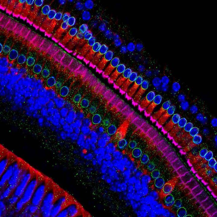 ear-hair-cells.jpg