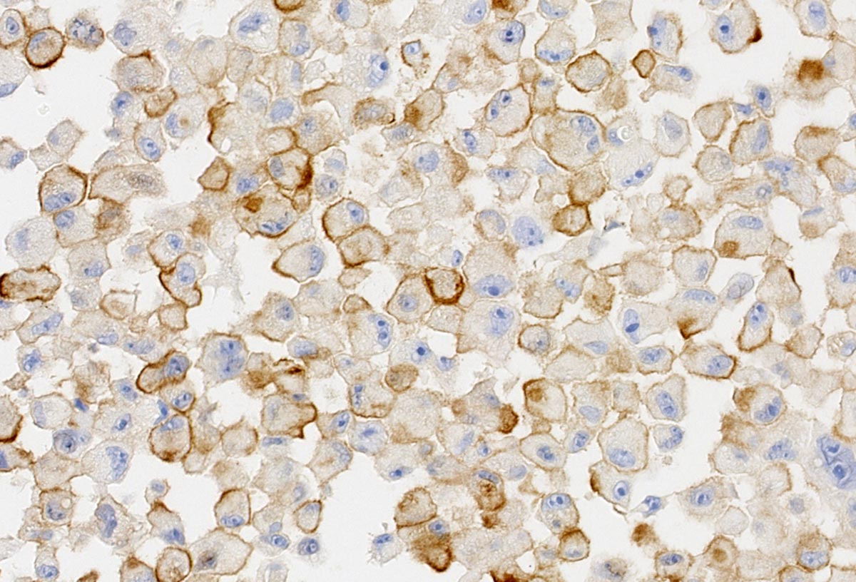 Senescent-Human-Melanoma-Tumor-Cells_jpg（JPEG 图像，1200x816 像素）_92.jpg