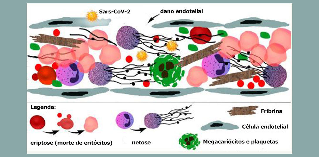 COVID-19-Is-a-Thrombotic-Disease-Graphic.jpg