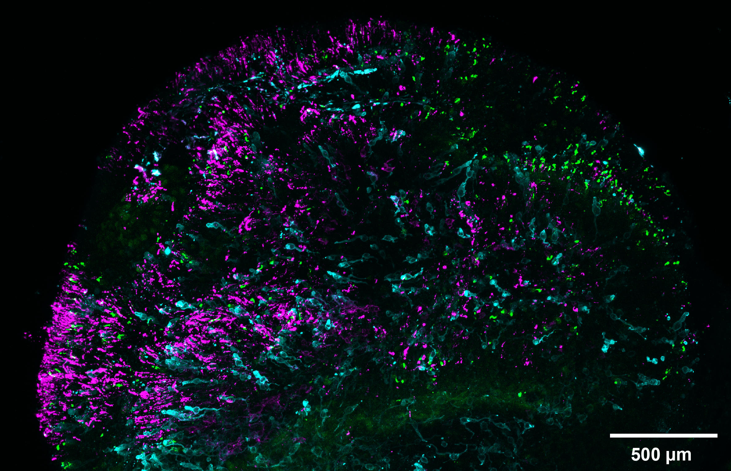 Organoid-Cones-Rods.jpg