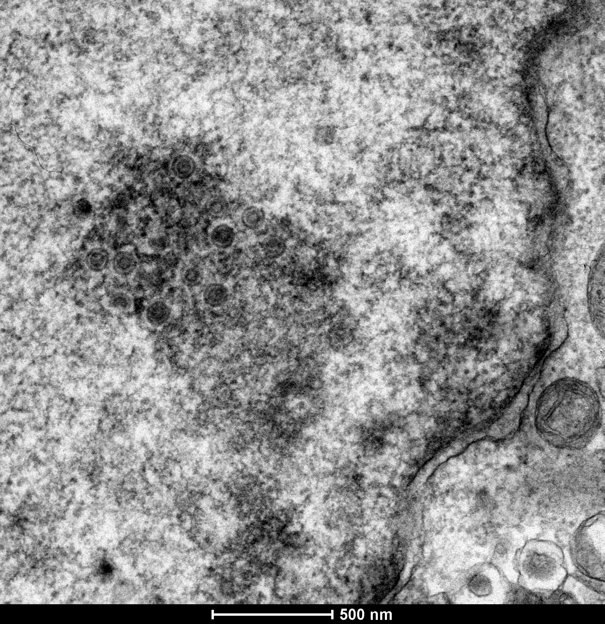 Mareks-Virus.jpg