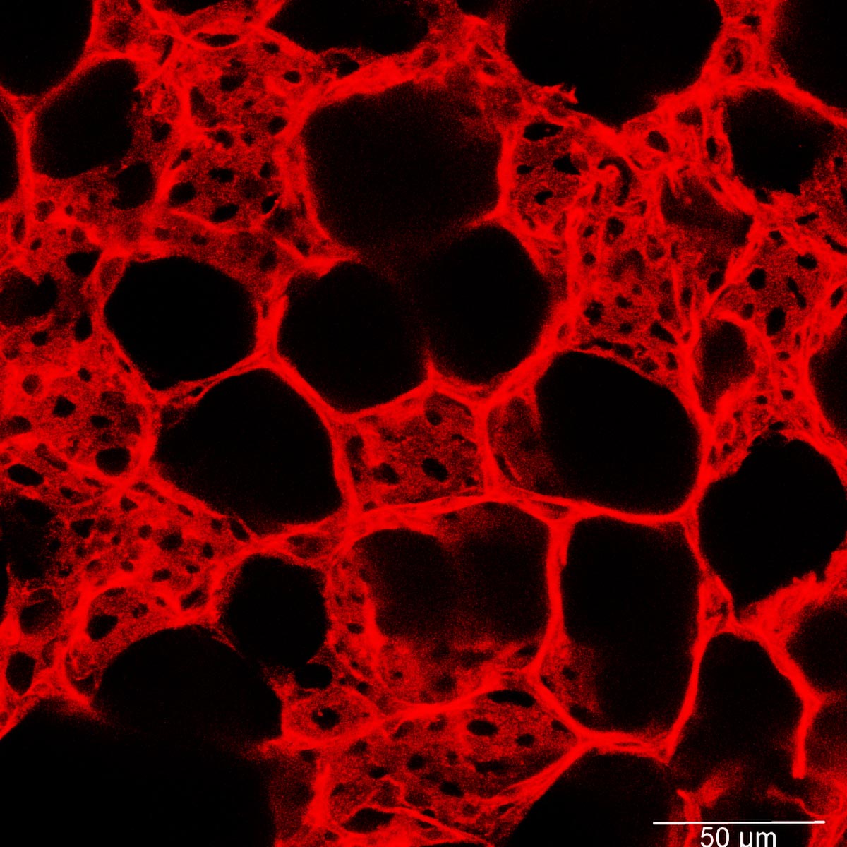 Dense-Network-Capillary-Blood-Vessels-Lung.jpg