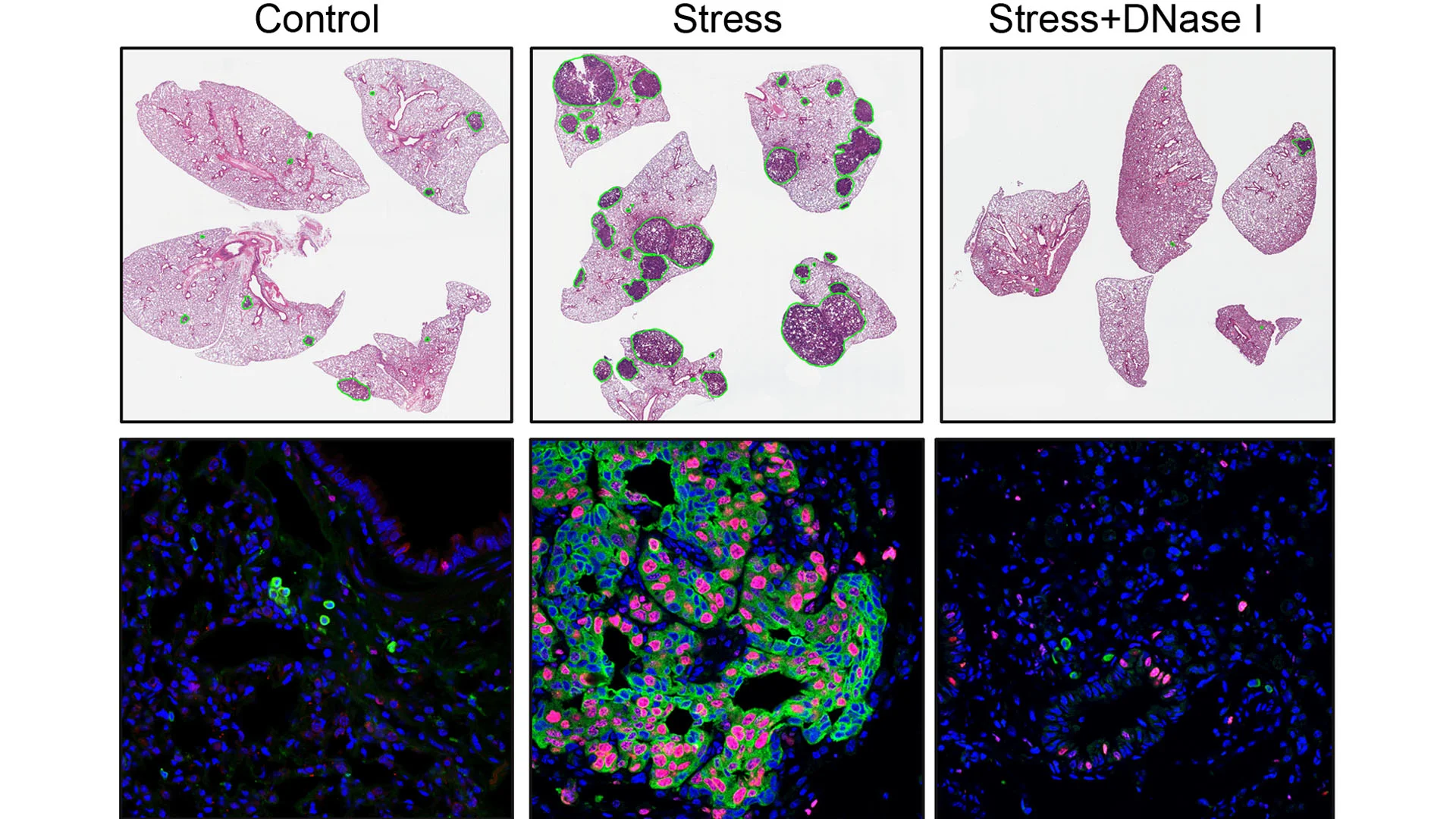 Cancer_stress_Dnase_I_Comparison.webp