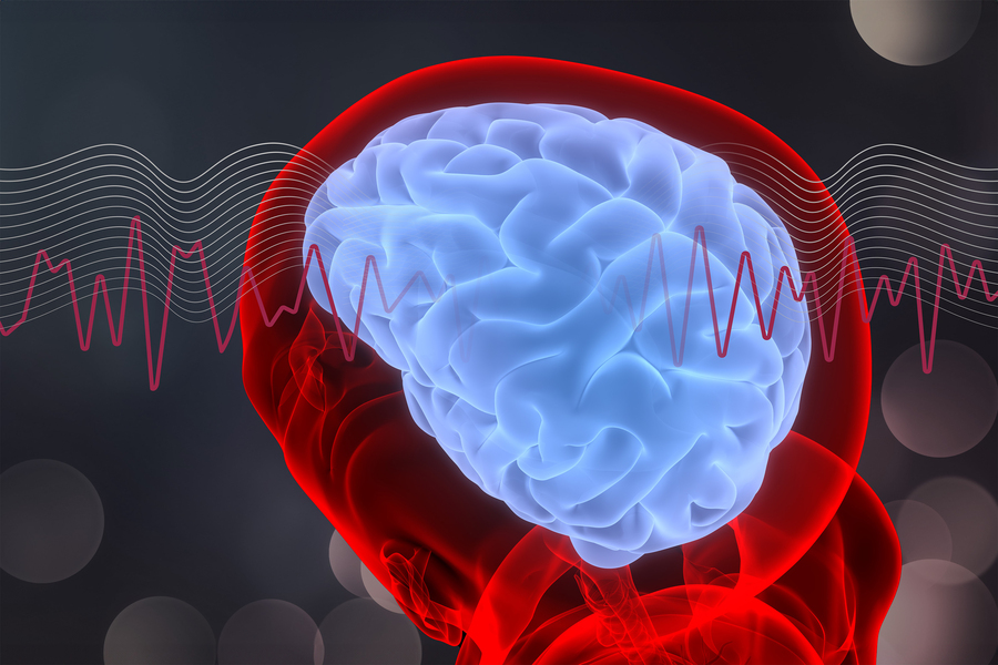 MIT_Chemobrain-01-PRESS_0.jpg