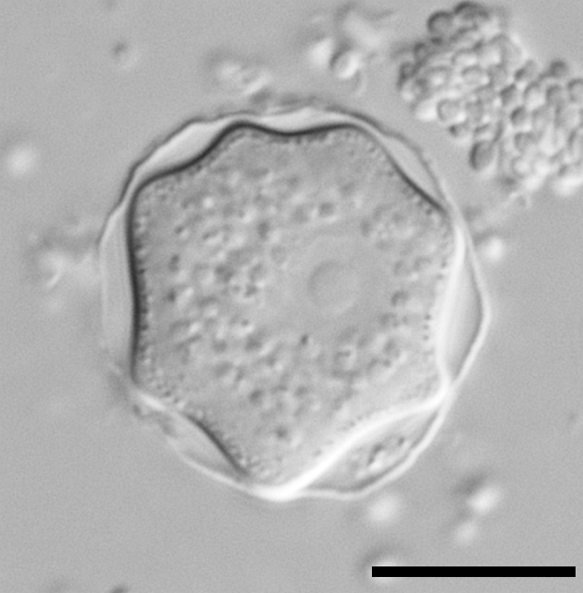 Parasite140120-fig4_Acanthamoeba_keratitis_Figure_4A.png