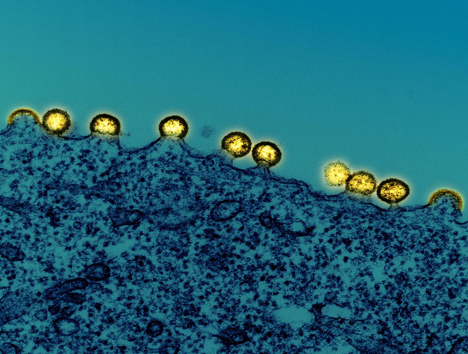 HIV-1-Virus-Particles.jpg