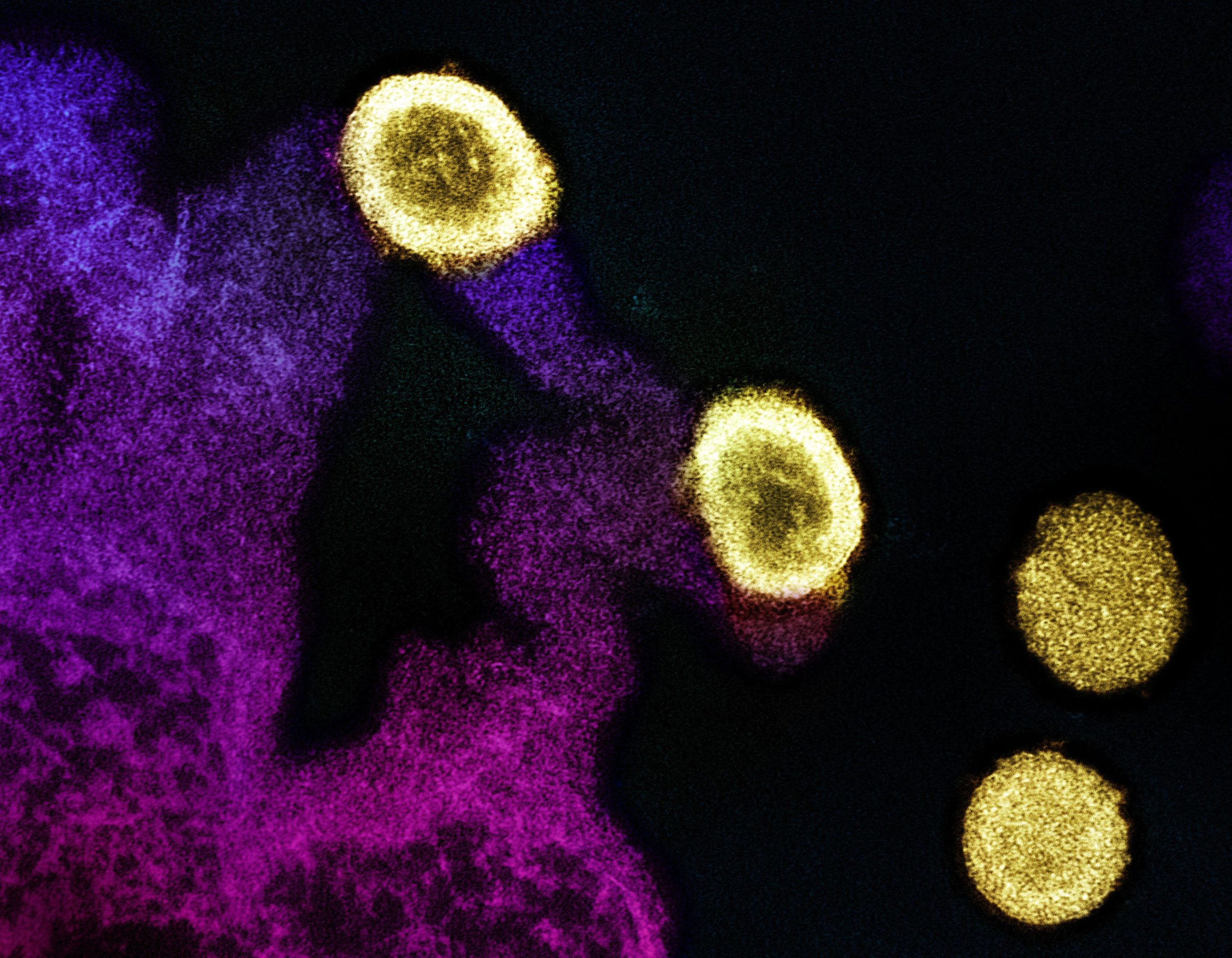 HIV-Virus-Particles-Transmission-Electron-Micrograph-scaled.jpg