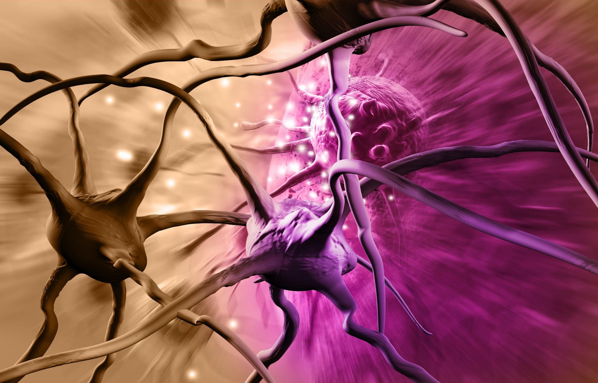Brain-Cancer-Cells-Neurons.jpg
