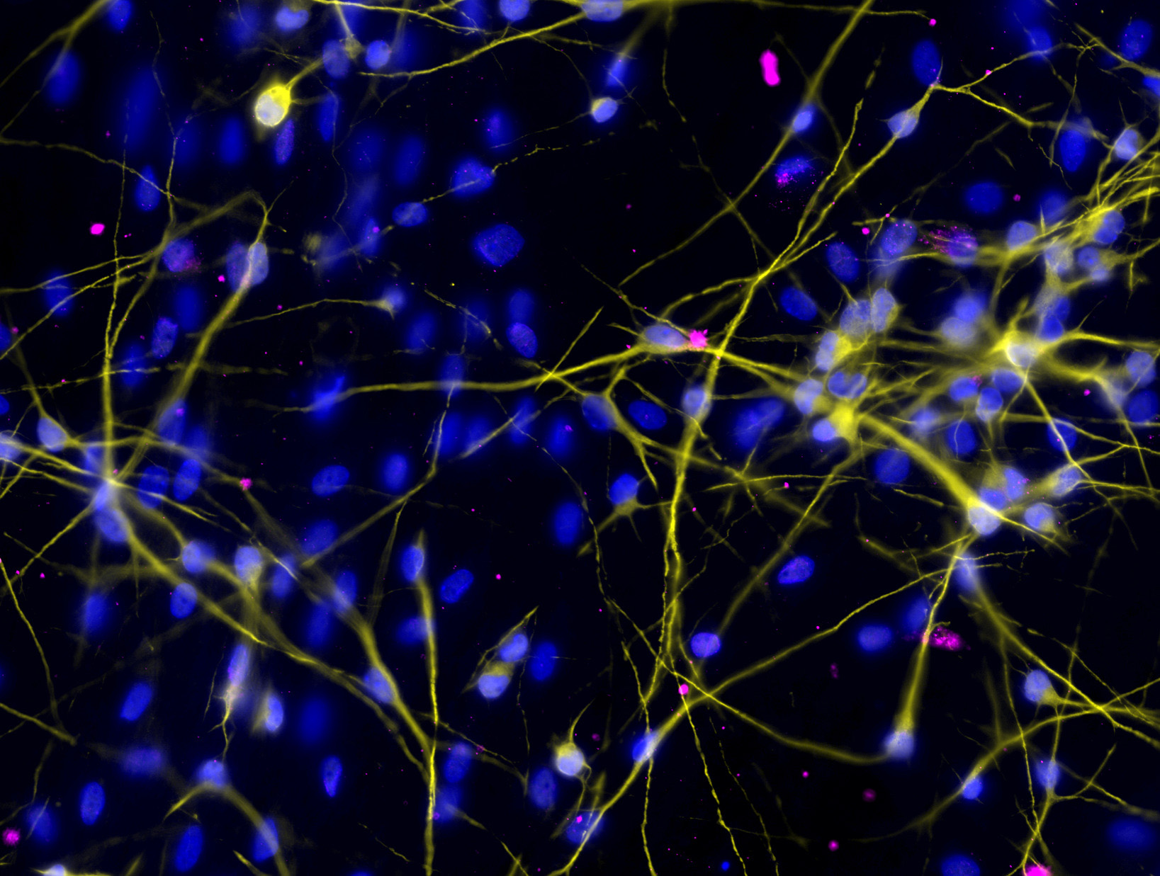 Cultured-Human-Neurons-Infected-With-ZIKV-LAV.jpg
