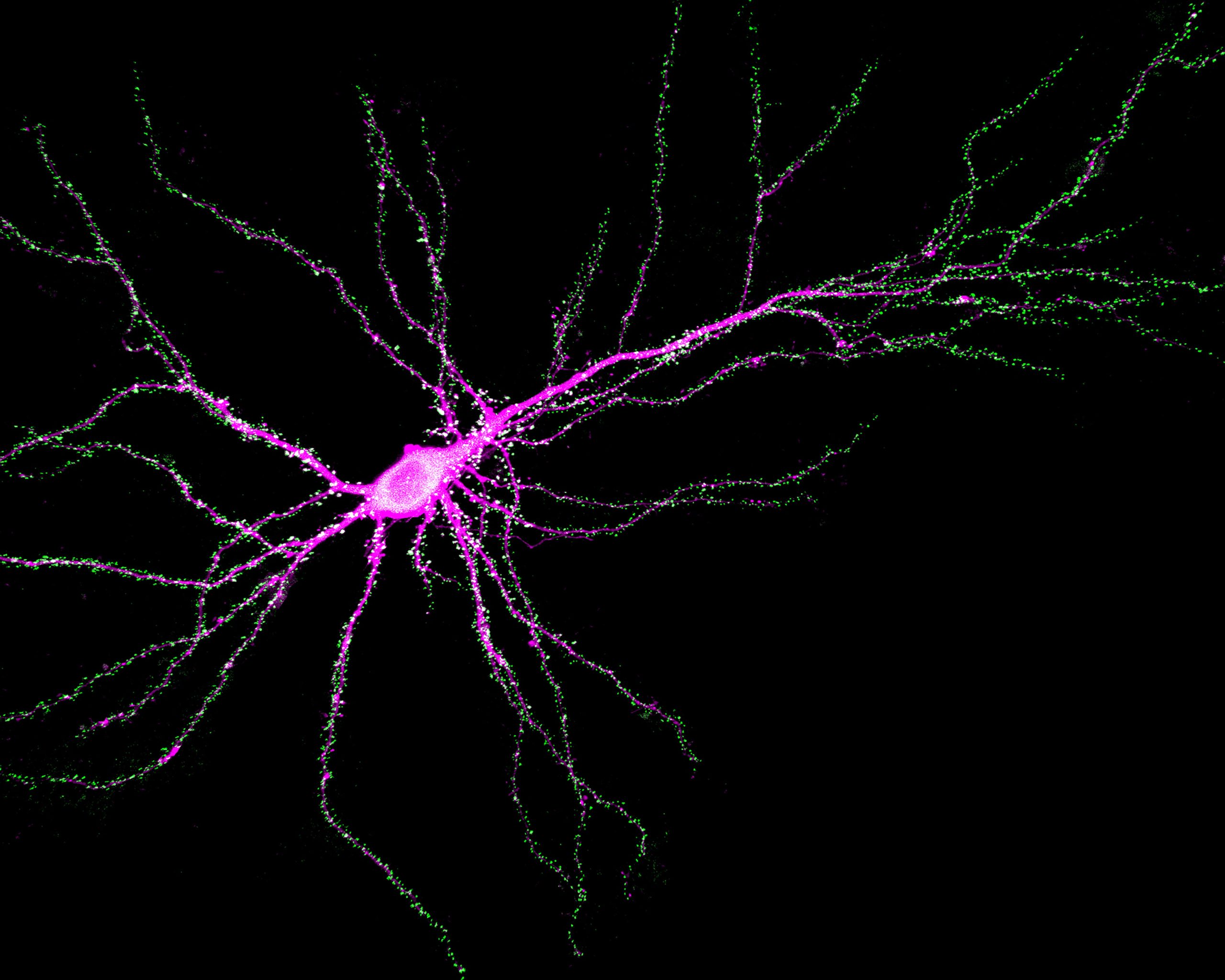 Neuron-Showing-SynGAP-Binding-to-PSD-95-at-Synapses-scaled.jpg