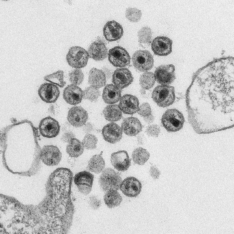 TEM-Microscopy-Image-of-HIV-Particles.jpg