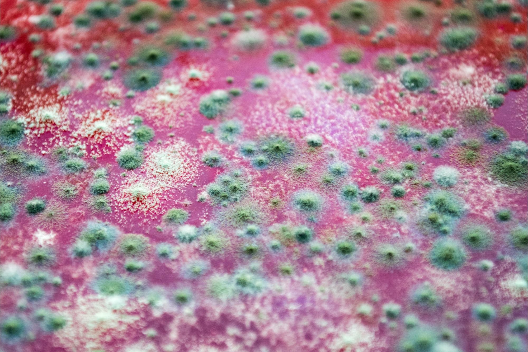 Fungal-Infection-Fungus.jpg