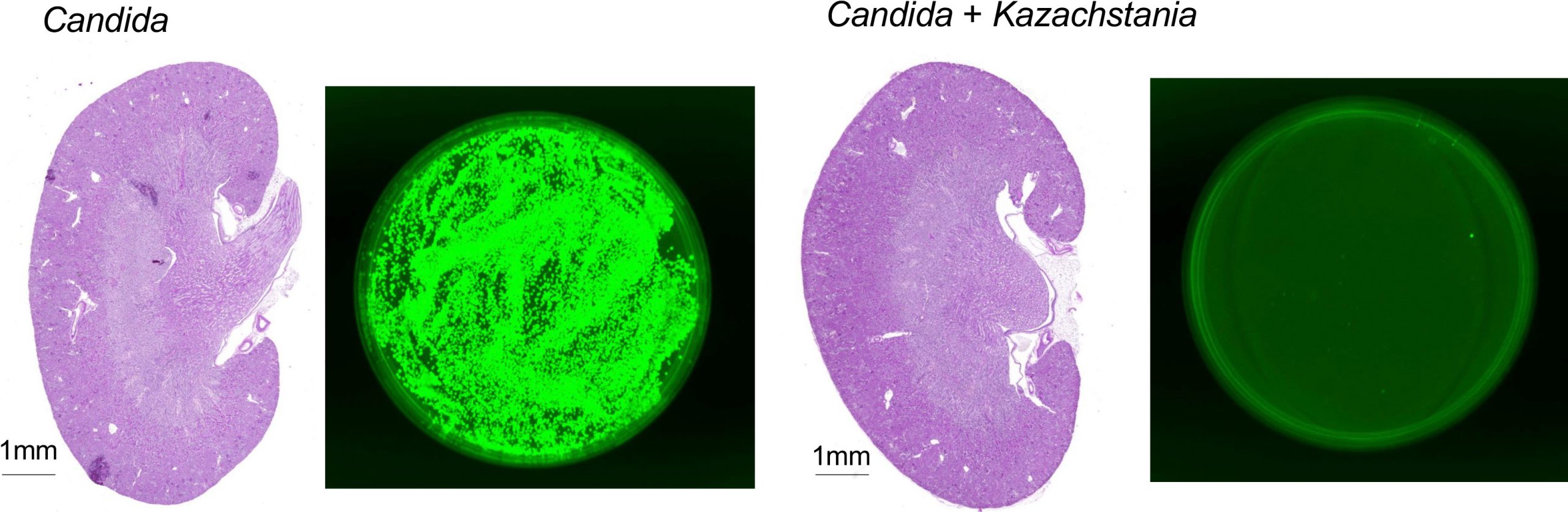 K.-weizmannii-Mitigates-Invasive-Candidiasis-in-Immunosuppressed-Mice-Graphic-scaled.jpg
