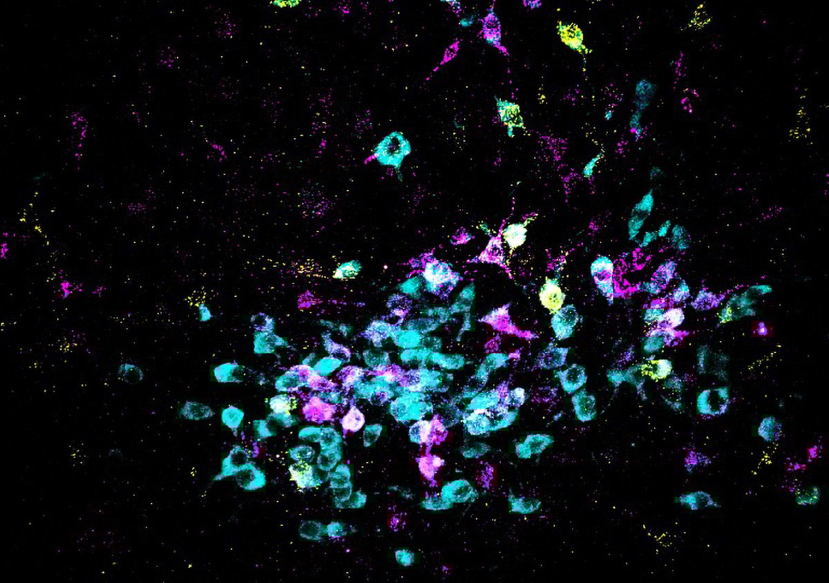 Neurons-Shown-in-Cyan-and-Retrograde-Tracers-Shown-in-Yellow-and-Magenta.jpg