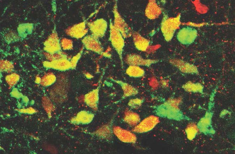 Dorsal-Raphe.jpg