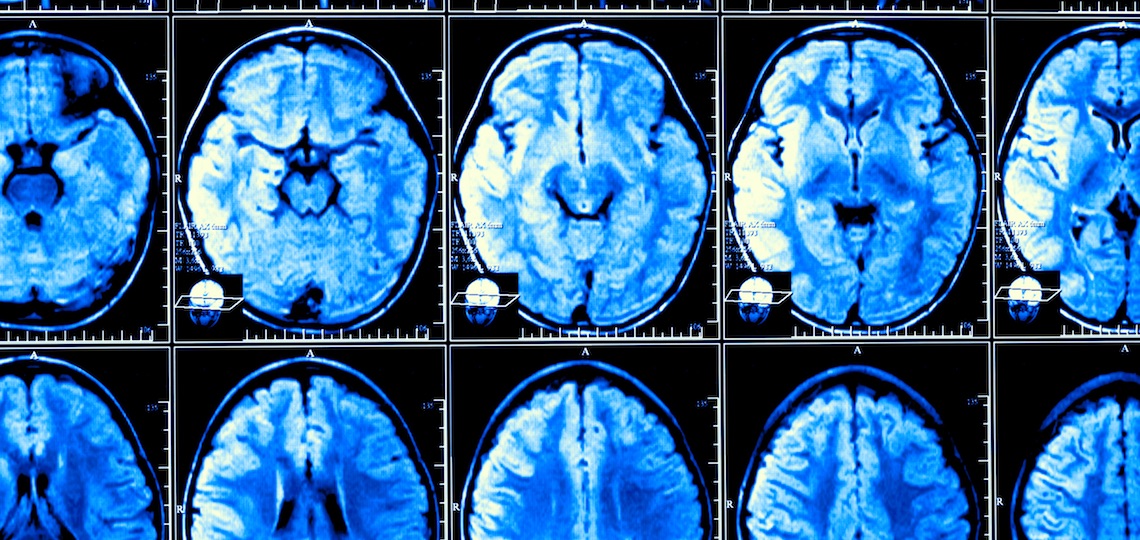 Brain_size_increasing_med_marquee.jpg